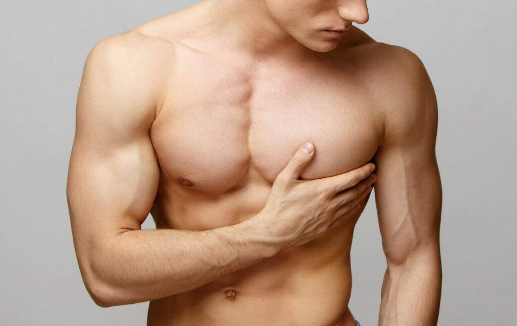 Gynecomastia in Tunisia