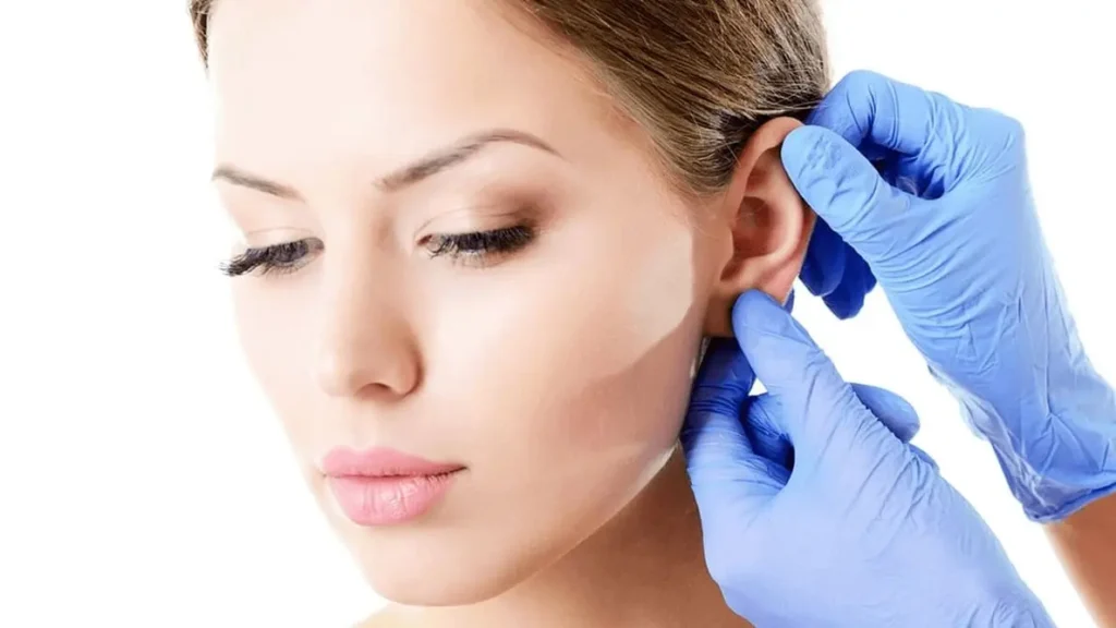 Otoplasty in Tunisia