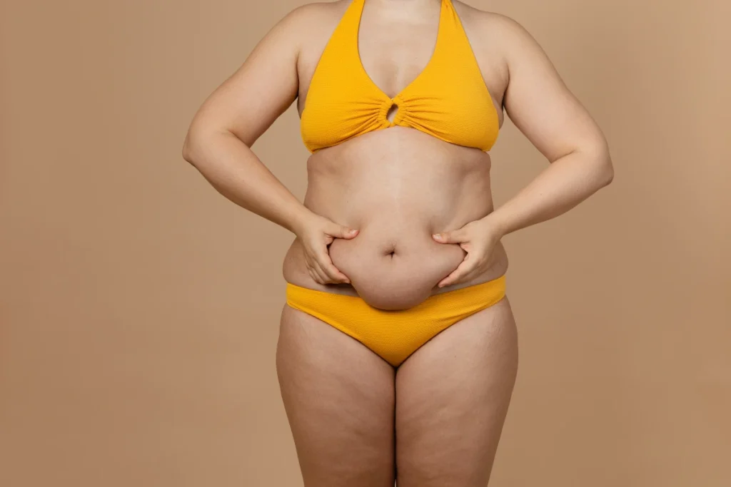 Tummy Tuck in Tunisia